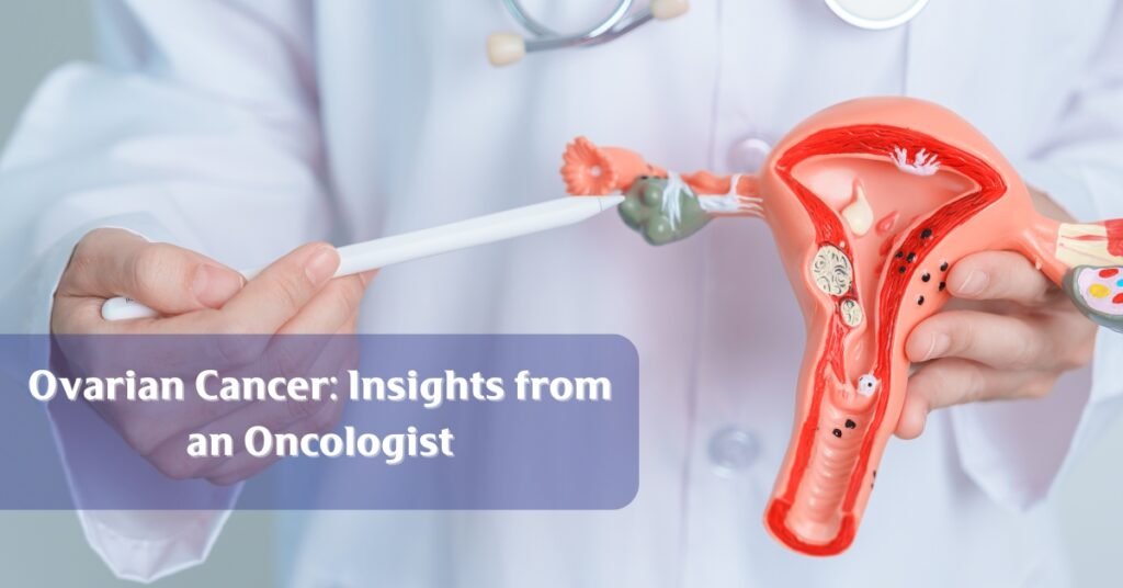 Ovarian Cancer Insights from an Oncologist