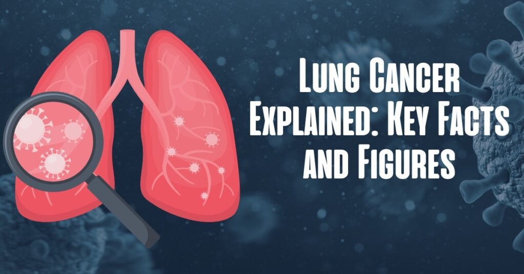 lung cancer