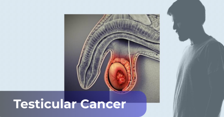 Testicular Cancer