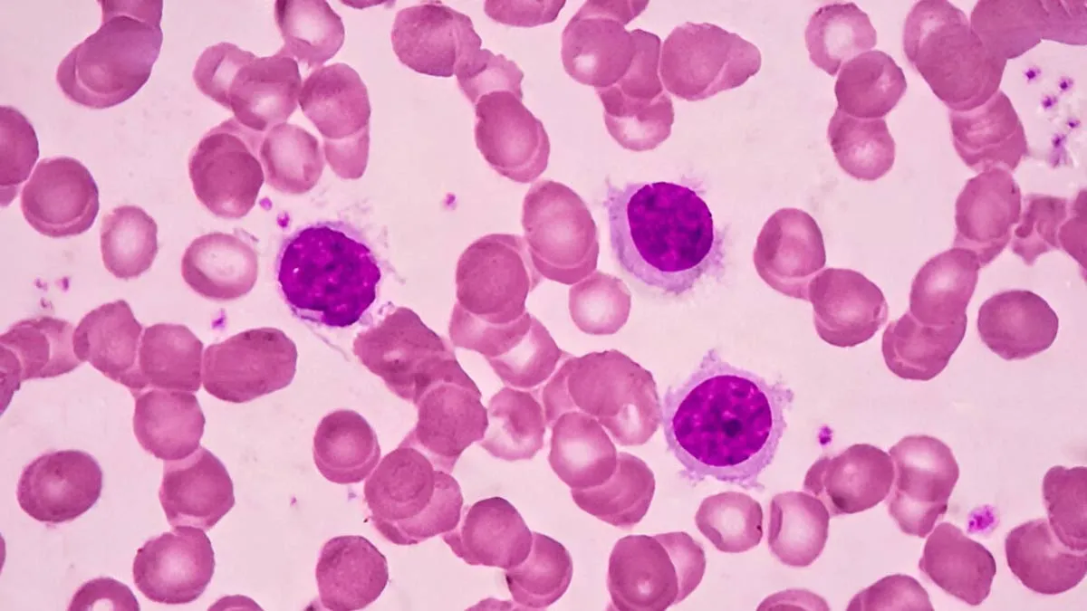 What Are Rare Cancers and Why Do They Demand Urgent Attention